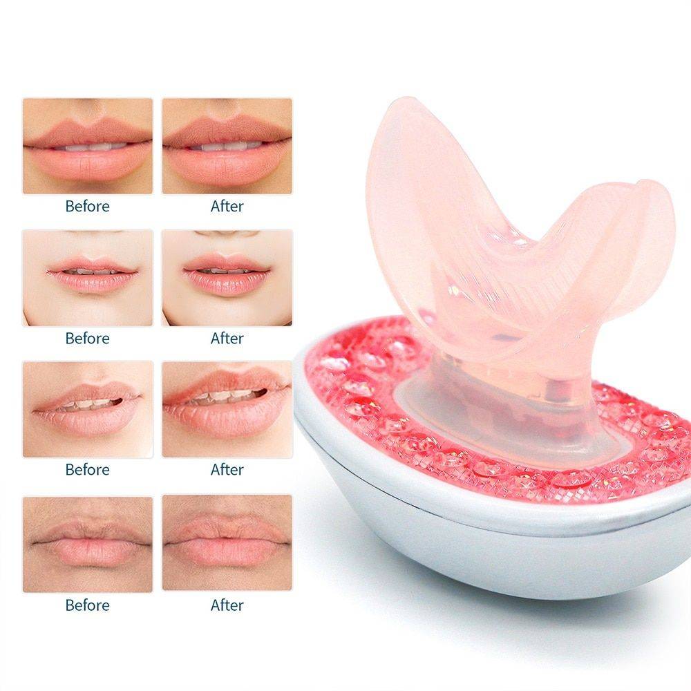 Rechargeable LED Lip Plumper Device: Restore & Enhance Natural Beauty Health & Beauty Skin Care Color : Blue|White|Red 