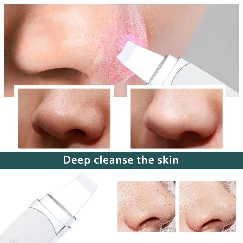 Ultrasonic Deep-Clean Skin Scrubber & Blackhead Remover Health & Beauty Skin Care Color : White 