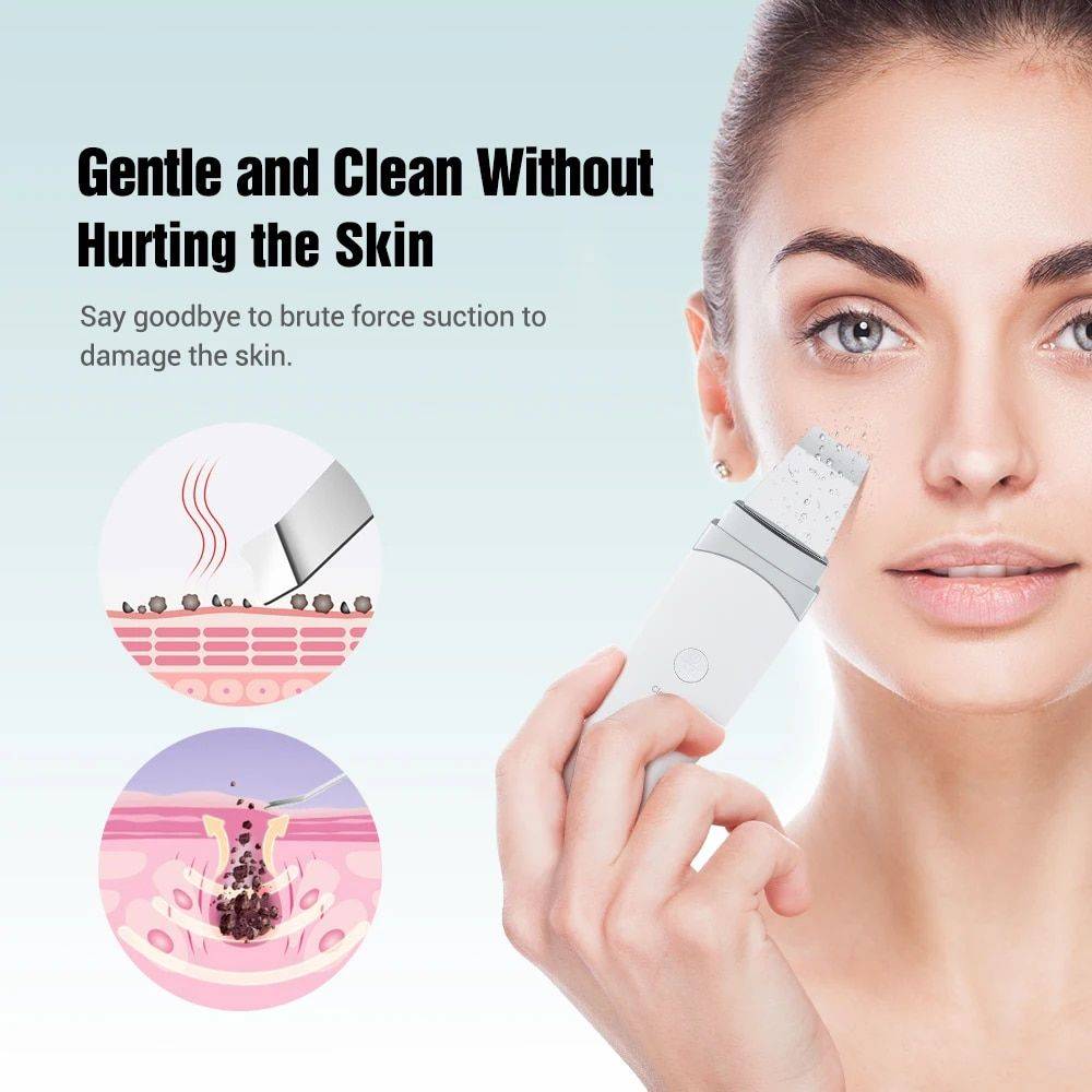 Ultrasonic Deep-Clean Skin Scrubber & Blackhead Remover Health & Beauty Skin Care Color : White 