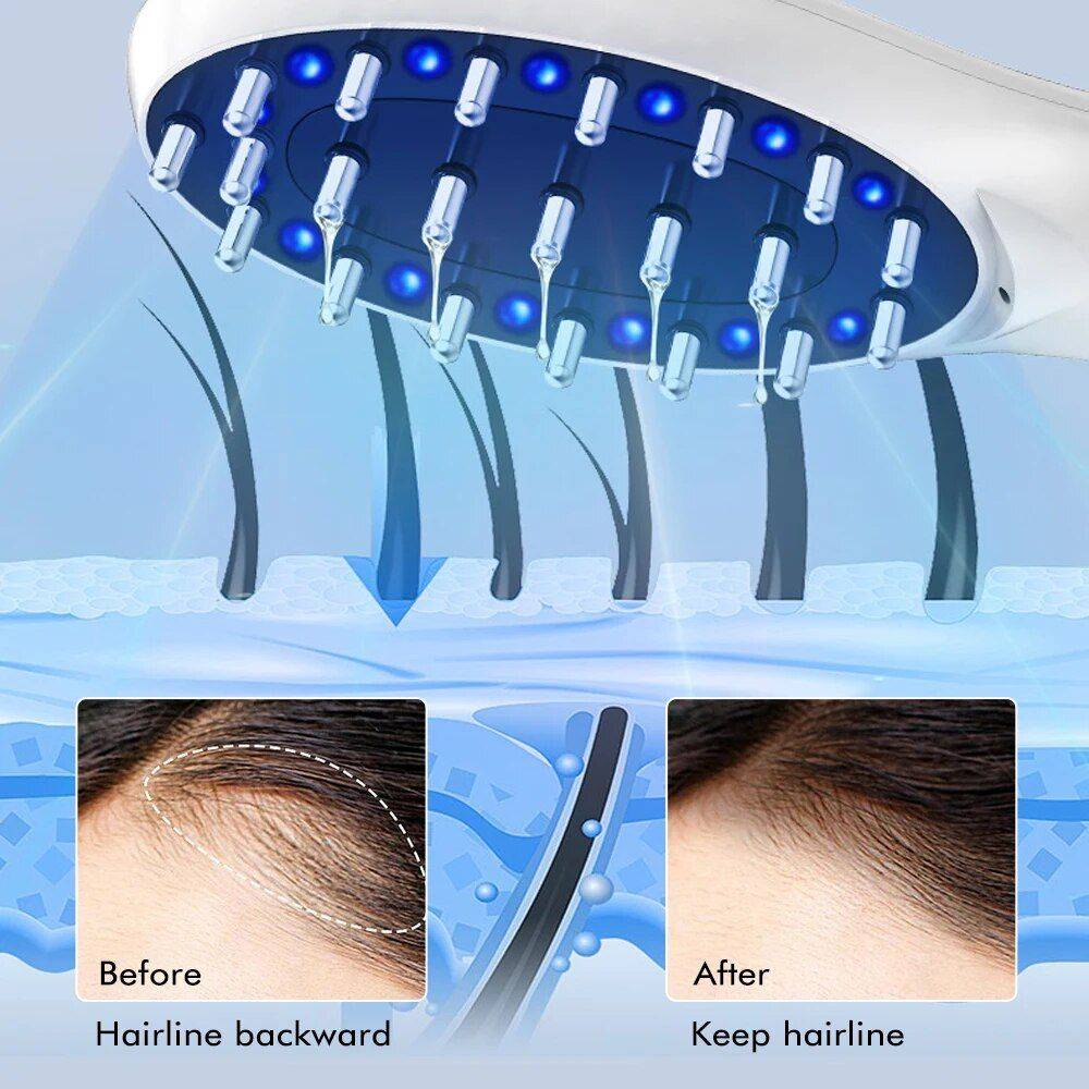 Electric Hair Growth and Scalp Health Massage Comb with Red/Blue Light Therapy Beauty Gadgets & Tools Gadgets Color : White 