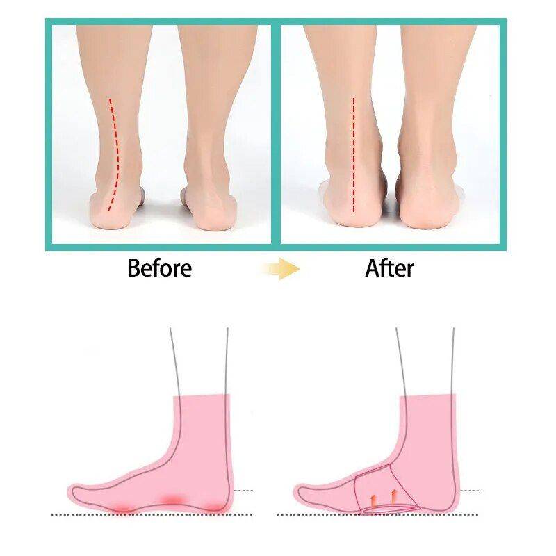 Ultimate Comfort Foot Arch Support Insoles - Orthopedic Pad for Flat Feet & Plantar Fasciitis Relief Foot, Hand & Nail Care Health & Beauty Color : White (2Pcs)|Skin (2Pcs)|White (4Pcs)|Skin (4Pcs)|Skin and white 